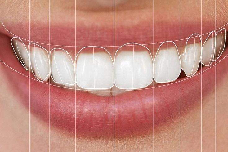 Digital Smile Design (DSD)